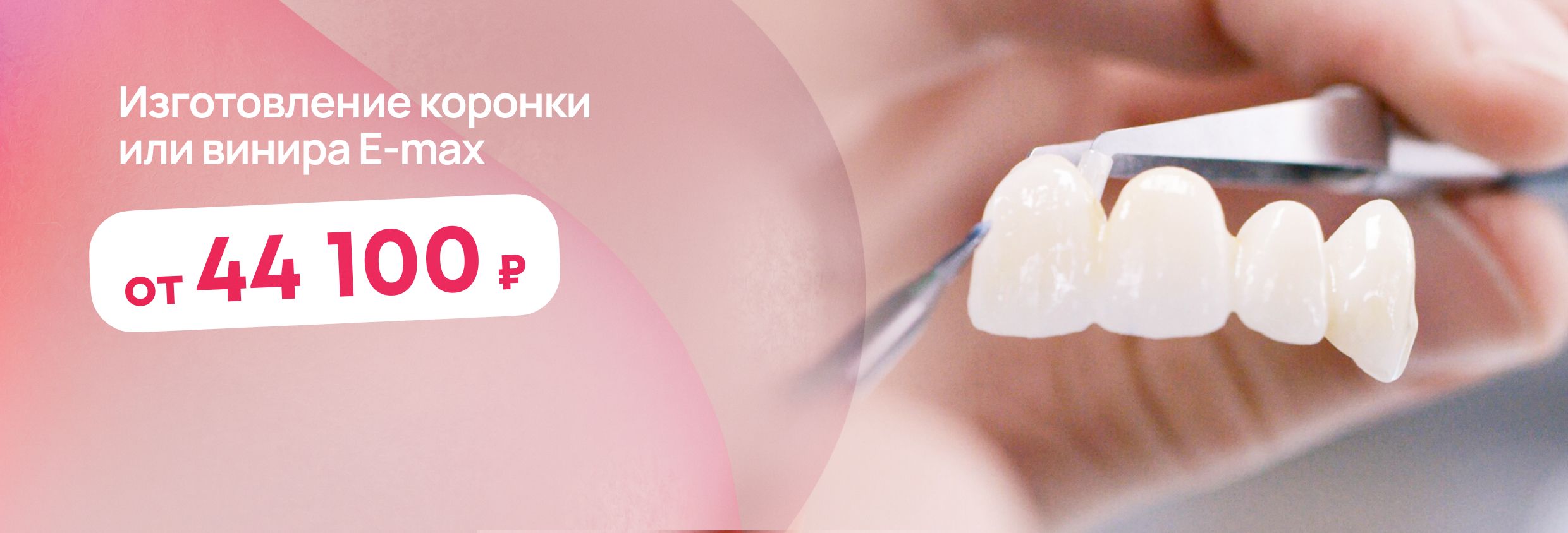 Коронка на зубы